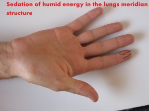 humidity-sedation-in-lungs1 humidity sedation in lungs